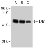 LKB1 (Ley 37D/G6): sc-32245. Western blot analysis of LKB1 expression in A-431 (A), 3611-RF (B) and MCF7 (C) whole cell lysates.
