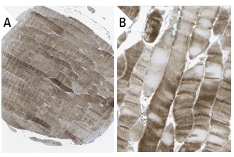 LKB1 (Ley 37D/G6): sc-32245. Immunoperoxidase staining of formalin fixed, paraffin-embedded human skeletal muscle tissue showing cytoplasmic staining of myocytes at low (A) and high (B) magnification. Kindly provided by The Swedish Human Protein Atlas (HPA) program.