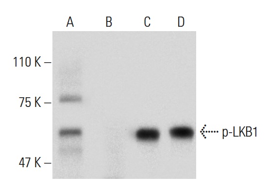 Western blot analysis of LKB1 phosphorylation in untreated (A,C) and lambda protein phosphatase (sc-200312A) treated (B,D) Caki-1 whole cell lysates. Antibodies tested include p-LKB1 (C-1): sc-271924 (A,B) and LKB1 (Ley 37D/G6): sc-32245 (C,D).