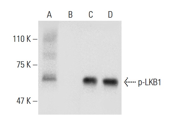 Western blot analysis of LKB1 phosphorylation in untreated (A,C) and lambda protein phosphatase (sc-200312A) treated (B,D) Caki-1 whole cell lysates. Antibodies tested include p-LKB1 (Ser 431): sc-28465 (A,B) and LKB1 (Ley 37D/G6): sc-32245 (C,D).