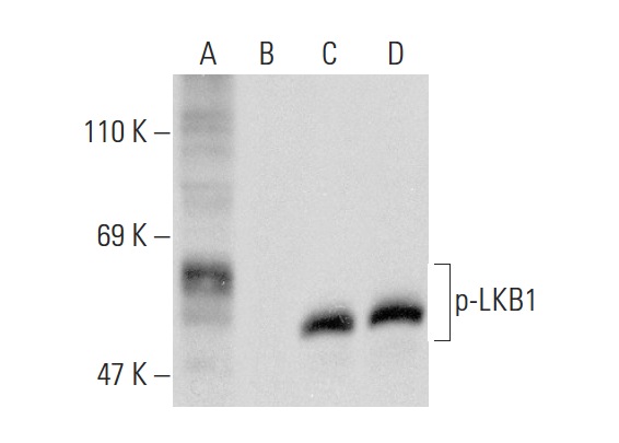 Western blot analysis of LKB1 phosphorylation in untreated (A,C) and lambda protein phosphatase treated (B,D) NIH/3T3 whole cell lysate. Antibodies tested include p-LKB1 (Ser 431)-R: sc-28465-R (A,B) and LKB1 (Ley 37D/G6): sc-32245 (C,D).