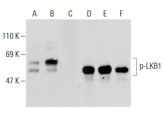 Western blot analysis of LKB1 phosphorylation in untreated (A,D), PMA treated (B,E) and PMA and lambda protein phosphatase (sc-200312A) treated (C,F) Jurkat whole cell lysates. Antibodies tested include p-LKB1 (C-1): sc-271924 (A,B,C) and LKB1 (Ley 37D/G6): sc-32245 (D,E,F).