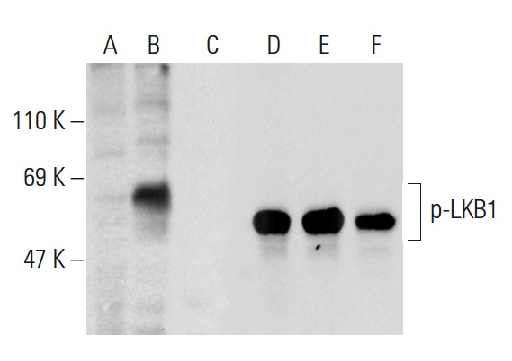 Western blot analysis of LKB1 phosphorylation in untreated (A,D), PMA treated (B,E) and PMA and lambda protein phosphatase (sc-200312A) treated (C,F) Jurkat whole cell lysates. Antibodies tested include p-LKB1 (Ser 431)-R: sc-28465-R (A,B,C) and LKB1 (Ley 37D/G6): sc-32245 (D,E,F).