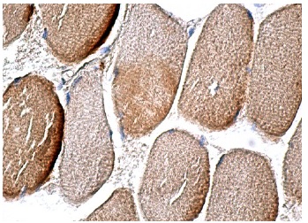 LKB1 (Ley 37D/G6): sc-32245. Immunoperoxidase staining of formalin fixed, paraffin-embedded human skeletal muscle tissue showing cytoplasmic staining of myocytes.
