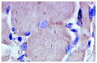 MEK-3 (I-20): sc-960. Immunoperoxidase staining of formalin-fixed, paraffin-embedded human muscle tissue showing cytoplasmic staining.