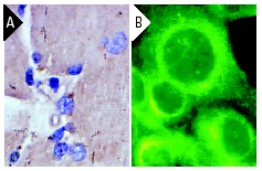 MEK-3 (I-20): sc-960. Immunoperoxidase staining of formalin-fixed, paraffin-embedded human muscle tissue showing cytoplasmic staining (A). Immunofluorescence staining of methanol-fixed NIH/3T3 cells showing cytoplasmic localization (B).