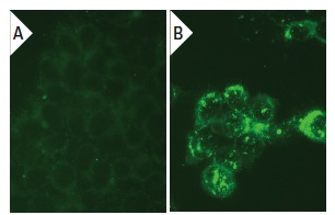 MEK-3 (30): sc-135985. Immunofluorescence staining of methanol-fixed untransfected (A) and human MEK-3 transfected HEK 293T cells (B).