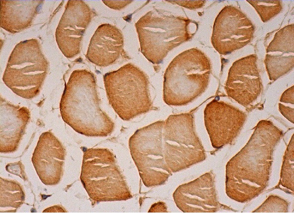 MEK-3/6 (H-90): sc-13069. Immunoperoxidase staining of formalin fixed, paraffin-embedded human skeletal muscle tissue showing cytoplasmic and nuclear staining of myocytes.