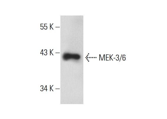 MEK-3/6 (D-3): sc-133230. Western blot analysis of MEK-3/6 expression in Jurkat whole cell lysate.