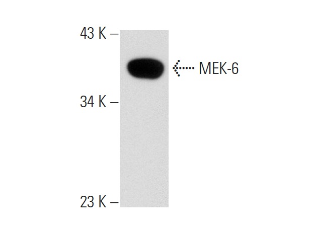MEK-6 (N-19): sc-1992. Western blot analysis of MEK-6 expression in COLO 320DM whole cell lysate.