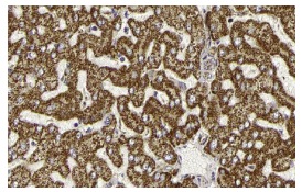 MEK kinase-1 (F-11): sc-17820. Immunoperoxidase staining of formalin fixed, paraffin-embedded human liver tissue showing cytoplasmic staining of hepatocytes and bile duct cells. Kindly provided by The Swedish Human Protein Atlas (HPA) program.