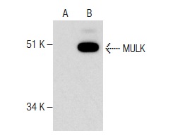 MULK (F-3): sc-374390. Western blot analysis of MULK expression in non-transfected: sc-117752 (A) and human MULK transfected: sc-113678 (B) 293T whole cell lysates.