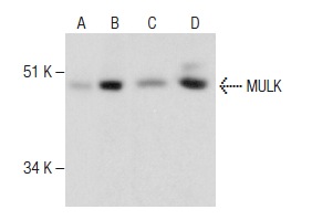 MULK (F-3): sc-374390. Western blot analysis of MULK expression in non-transfected 293T: sc-117752 (A), mouse MULK transfected 293T: sc-121865 (B), A-431 (C) and K-562 (D) whole cell lysates.