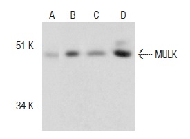 MULK (F-3): sc-374390. Western blot analysis of MULK expression in non-transfected 293T: sc-117752 (A), mouse MULK transfected 293T: sc-121864 (B), A-431 (C) and K-562 (D) whole cell lysates.