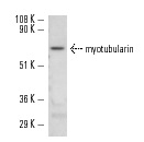 myotubularin (N-20): sc-14781. Western blot analysis of myotubularin expression in Hep G2 whole cell lysate.