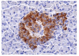 nm23-H1 (NM301): sc-465. Immunoperoxidase staining of formalin fixed, paraffin-embedded human pancreas tissue showing cytoplasmic staining of Islets of Langerhans.