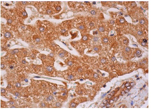 p38β (E-20)-R: sc-6187-R. Immunoperoxidase staining of formalin fixed, paraffin-embedded human liver tissue showing cytoplasmic staining of hepatocytes and bile duct cells.