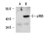 p38β (N-14): sc-15918. Western blot analysis of p38β expression in control COS cells (A) and COS cells transfected with a p38β expression vector (B).