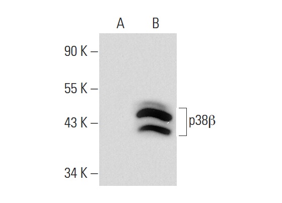 p38β (N-14): sc-15918. Western blot analysis of p38β expression in non-transfected: sc-117752 (A) and human p38β transfected: sc-174918 (B) 293T whole cell lysates.