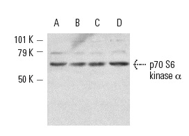 p70 S6 kinase α (C-18): sc-230. Western blot analysis of p70 S6 kinase α expression in HeLa (A), NIH/3T3 (B) and KNRK (C) whole cell lysates and rat liver tissue (D).