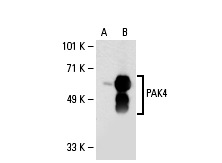 PAK4 (P-21): sc-18622. Western blot analysis of PAK4 expression in non-transfected: sc-110760 (A) and human PAK4 transfected: sc-111101 (B) 293 whole cell lysates.