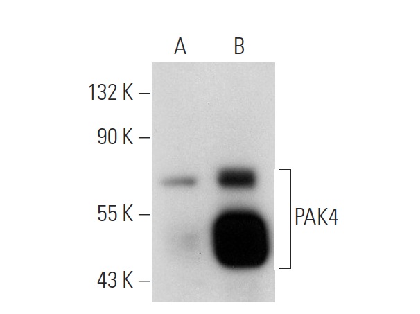 PAK4 (P-21): sc-18622. Western blot analysis of PAK4 expression in non-transfected: sc-117752 (A) and human PAK4 transfected: sc-173381 (B) 293T whole cell lysates.