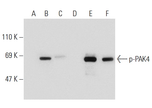 Western blot analysis of PAK4 phosphorylation in non-transfected: sc-110760 (A,D), untreated human PAK4 transfected: sc-111101 (B,E) and lambda protein phosphatase (sc-200312A) treated human PAK4 transfected: sc-111101 (C,F) 293 whole cell lysates. Antibodies tested include p-PAK4 (71.Ser 474): sc-135774 (A,B,C) and PAK4 (6C1): sc-81532 (D,E,F).