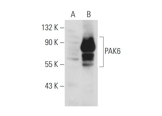 PAK6 (H-300): sc-32857. Western blot analysis of PAK6 expression in non-transfected: sc-117752 (A) and human PAK6 transfected: sc-158808 (B) 293T whole cell lysates.
