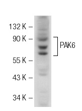 PAK6 (H-300): sc-32857. Western blot analysis of PAK6 expression in SK-N-MC whole cell lysate.
