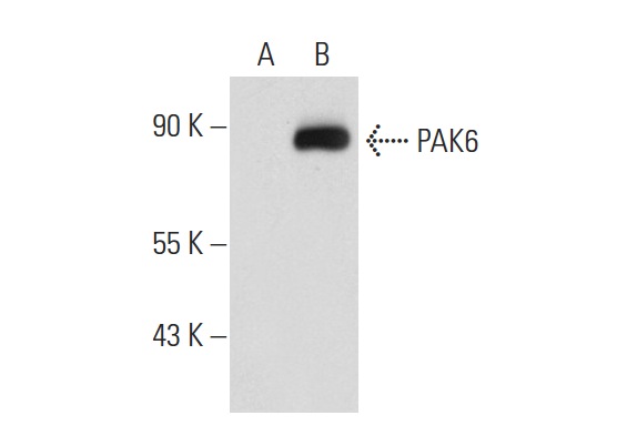 PAK6 (N-20): sc-25975. Western blot analysis of PAK6 expression in non-transfected: sc-117752 (A) and human PAK6 transfected: sc-158808 (B) 293T whole cell lysates.