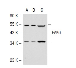 PAK6 (N-20): sc-25975. Western blot analysis of PAK6 expression in non-transfected 293T: sc-117752 (A), human PAK6 transfected 293T: sc-115034 (B) and SK-N-MC (C) whole cell lysates.