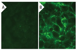 PAK6 (N-20): sc-25975. Immunofluorescence staining of methanol-fixed untransfected (A) and human PAK6 transfected HEK 293T cells (B).