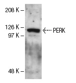 PERK (H-300): sc-13073. Western blot analysis of PERK expression in NIH/3T3 whole cell lysate.