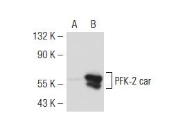 PFK-2 car (Y-13): sc-50956. Western blot analysis of PFK-2 car expression in non-transfected: sc-117752 (A) and mouse PFK-2 car transfected: sc-122508 (B) 293T whole cell lysates.
