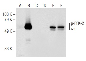 Western blot analysis of PFK-2 car phosphorylation in non-transfected: sc-117752 (A,D), untreated mouse PFK-2 car transfected: sc-122507 (B,E) and lambda protein phosphatase (sc-200312A) treated mouse PFK-2 car transfected: sc-122507 (C,F) 293T whole cell lysates. Antibodies tested include p-PFK-2 car (Ser 483): sc-32967 (A,B,C) and PFK-2 car (Y-13): sc-50956 (D,E,F).