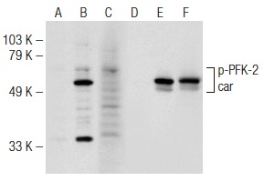 Western blot analysis of PFK-2 car phosphorylation in non-transfected: sc-117752 (A,D), untreated mouse PFK-2 car transfected: sc-122507 (B,E) and lambda protein phosphatase (sc-200312A) treated mouse PFK-2 car transfected: sc-122507 (C,F) 293T whole cell lysates. Antibodies tested include p-PFK-2 car (B-3): sc-373806 (A,B,C) and PFK-2 car (Y-13): sc-50956 (D,E,F).