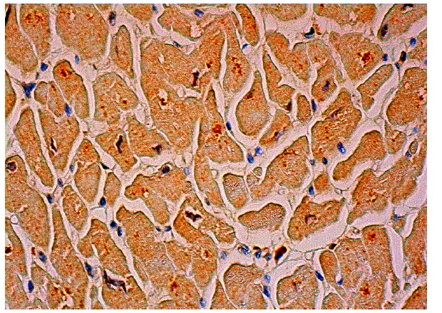 PFK-2 car (Y-13): sc-50956. Immunoperoxidase staining of formalin fixed, paraffin-embedded human heart muscle tissue showing cytoplasmic staining of myocytes.