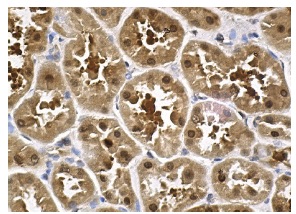 PGK1 (Y-12): sc-17943. Immunoperoxidase staining of formalin fixed, paraffin-embedded human kidney tissue showing nuclear and cytoplasmic staining of cells in tubules.