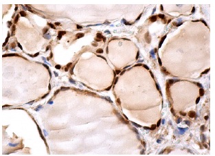 PGK1/2 (A-5): sc-48342. Immunoperoxidase staining of formalin fixed, paraffin-embedded human thyroid tissue showing nuclear and cytoplasmic staining of glandular cells.