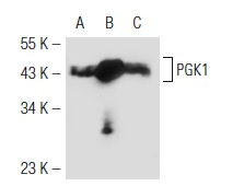 PGK1/2 (H-300): sc-28784. Western blot analysis of PGK1 expression in non-transfected 293T: sc-117752 (A), mouse PGK1 transfected 293T: sc-122519 (B) and HeLa (C) whole cell lysates.