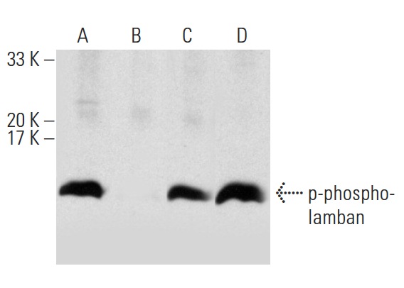 Western blot analysis of phospholamban phosphorylation in untreated (A,C) and lambda protein phosphatase (sc-200312A) treated (B,D) mouse heart tissue extract. Antibodies tested include p-phospholamban (Ser 16)-R: sc-12963-R (A,B) and phospholamban (L-15): sc-21923 (C,D).