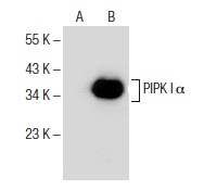 PIPK I α (E-3): sc-376195. Western blot analysis of PIPK I α expression in non-transfected: sc-117752 (A) and mouse PIPK I α transfected: sc-122588 (B) 293T whole cell lysates.