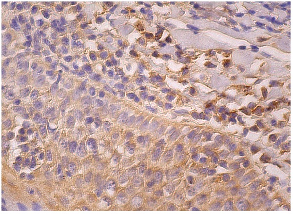 PIPK I α (E-3): sc-376195. Immunoperoxidase staining of formalin fixed, paraffin-embedded human tonsil tissue showing cytoplasmic staining of cells in non-germinal center and squamous epithelial cells.