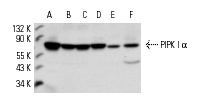 PIPK I α (C-17): sc-11774. Western blot analysis of PIPK I α expression in HeLa (A), K-562 (B), THP-1 (C), SK-N-SH (D) and NIH/3T3 (E) whole cell lysates and mouse brain extract (E).