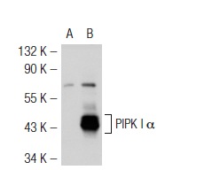 PIPK I α (C-17): sc-11774. Western blot analysis of PIPK I α expression in non-transfected: sc-117752 (A) and mouse PIPK I α transfected: sc-122588 (B) 293T whole cell lysates.