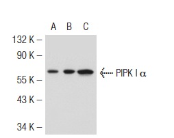 PIPK I α (C-17): sc-11774. Western blot analysis of PIPK I α expression in non-transfected 293T: sc-117752 (A), mouse PIPK I α transfected 293T: sc-122589 (B) and HeLa (C) whole cell lysates.