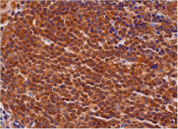 PIPK I α (C-17): sc-11774. Immunoperoxidase staining of formalin fixed, paraffin-embedded human lymph node tissue showing cytoplasmic and nuclear staining of cells in germinal and non-germinal centers.