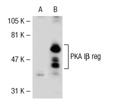 PKA I7α/β reg (H-90): sc-28893. Western blot analysis of PKA Iβ reg expression in non-transfected: sc-117752 (A) and human PKA Iβ reg transfected: sc-112159 (B) 293T whole cell lysates.