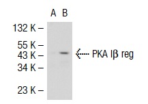 PKA Iα/β reg (H-90): sc-28893. Western blot analysis of PKA Iβ reg expression in non-transfected: sc-117752 (A) and mouse PKA Iβ reg transfected: sc-125829 (B) 293T whole cell lysates.