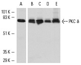 Western blot analysis of PKC δ expression in 3611-RF (A), A-431 (B), HeLa (C), Jurkat (D) and K-562 (E) whole cell lysates. Antibodies tested include PKC δ (C-17): sc-213 (A) and PKC δ (C-20): sc-937 (B-E).